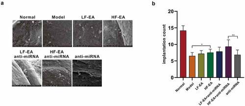 Figure 2. Effects of electroacupuncture and miR-223-3p toward rats’ endometrial blastocyst implantation ability (A) Observation with Scanning Electron Microscope toward Rats’ Pinopodes of Endometrial Epithelial Cells (B) Effects of electroacupuncture and miR-223-3p on the number of rats’ blastocyst implantation in each group. Data were presented in a manner of mean ± SD (n ≥ 3 experiments). Outcomes of *p < 0.05, **p < 0.01, ***p < 0.001, ****p < 0.0001 were determined via Student<apos;>s t-test (two groups) or one-way ANOVA, subsequently with Tukey<apos;>s test (more than two groups).