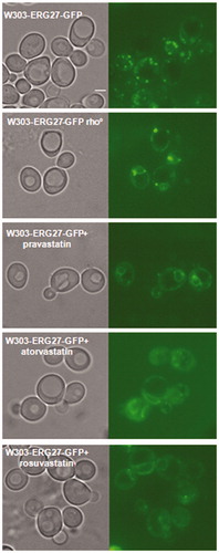 Figure 5. Statins treatments induced the re-localization of Erg27, a sensor of mitochondrial state, from lipid droplets to nuclear and cortical ER. The Erg27 localization in wild type cells is predominantly in lipid droplets, while in rho° cells the enzyme is mainly in nuclear and cortical endoplasmic reticulum. Wild type W303 with the ERG27-GFP fusion integrated in the genome was visualized at fluorescence microscopy after statins treatments, pravastatin 150µg/ml, atorvastatin 100µg/ml and rosuvastatin 50µg/ml in exponential growth phase in YPD medium. Bar: 2 µm. The magnification is the same in each picture.