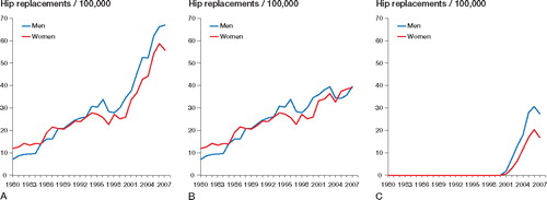 Figure 2. A. Incidence of all hip arthroplasties for primary osteoarthritis in young patients (30–59 years of age), by sex. The increase in incidence during 1980–2007 was greater in men than in women (p < 0.001). B. Incidence of total hip arthroplasty (THA) for primary osteoarthritis in young patients (30–59 years of age), by sex. C. Incidence of resurfacing hip arthroplasty (RHA) for primary osteoarthritis in young patients (30–59 years of age), by sex. The increase in incidence during 2001–2007 was greater in men than in women (p < 0.001).