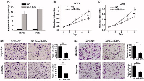 Figure 2. miR-199a suppresses renal cancer cell growth and metastasis. (A) Successful overexpression of miR-199a was confirmed by qRT-PCR after infection with miR-199a-expressing or vector control lentivirus. (B, C) Cell proliferation was measured by WST-1 assay at different time points. (D, E) Transwell migration and invasion assays. Representative images are shown in the left, and the quantification of 10 randomly selected fields is shown in the right. **p < .01.