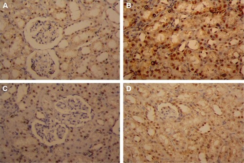 Figure 7 Changes in caspase-3 expression in rat renal cells after the administration of IOLE and PbAc for 5 days.