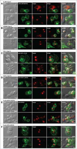 Figure 7. Cell surface trafficking of membrane-anchored proteins in Russell body-positive cells. Fluorescent micrographs of HEK293 cells co-transfected with N35W variant LC construct and one of the expression constructs encoding the following plasma membrane protein. Type I membrane proteins: (A) human IL-36R and (B) human CD200R. Type II membrane proteins: (C) human FAPα and (D) human CD27L. Polytopic membrane proteins: (E) N-terminally FLAG-tagged human GPR34 and (F) N-terminally FLAG-tagged human GPR4. On day-2 post transfection, suspension cultured cells were seeded onto poly-lysine coated glass coverslips and statically incubated for 24 hr. On day-3, cells were fixed, permeabilized, and co-stained with Texas Red-conjugated anti-kappa chain polyclonal antibody and the following antibodies. (A) Mouse anti-human IL-36R monoclonal antibody, clone M145. (B) Mouse anti-human CD200R monoclonal antibody, clone 380525. (C) Mouse anti-human FAPa monoclonal antibody clone F19. (D) Mouse anti-human CD27L monoclonal antibody, clone BU69. (E) Mouse anti-human GPR34 monoclonal antibody, clone 419859. (F) Mouse anti-FLAG monoclonal antibody, clone M2. Green and red image fields were superimposed to create ‘merge’ views. DIC and ‘merge’ were superimposed to generate ‘overlay’ views. Unlabeled scale bar represents 10 μm.