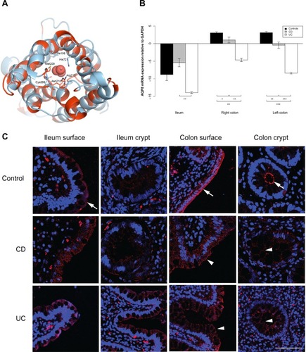 Figure 4 AQP8 expression is reduced in the ileum and colon of UC patients.