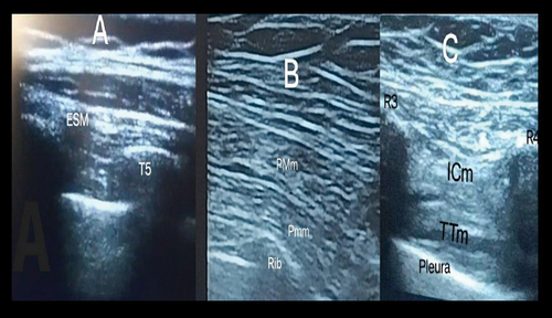 Figure 2. Ultrasonographic visualization of different study blocks.