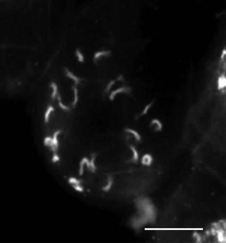 Figure 3. Prometaphase mitotic chromosomes of Euphrasia “Ultental,” 2n = 22. Scale bar, 5 µm.