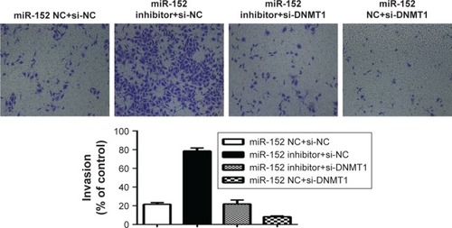 Figure 5 Knockdown of DNMT1 reversed the effect of miR-152 inhibition on the invasion of NPC cells. Transwell analysis showed that the downregulation of DNMT1 antagonized positive effects of miR-152 inhibitor on invasion of CNE-2 cells after the CNE-2 cells were transfected with miR-152 inhibitor or si-DNMT1.