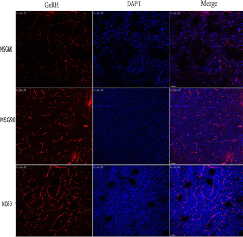 Figure 4 Effects of monosodium glutamate on GnRH neurons. The immunofluorescence intensity of immunofluorescent GnRH-positive neuronal cell bodies and fibers in both monosodium glutamate groups was weaker than in the control group. The number of immunofluorescent GnRH-positive neuronal cell bodies and fibers in the immunofluorescence staining group was significantly less than in the control group. The immunofluorescence intensity of the MSG90 group was slightly stronger than the MSG60 group. There was no significant difference in the number of immunofluorescent GnRH-positive neuronal cell bodies and fibers: bar, 100 μm.