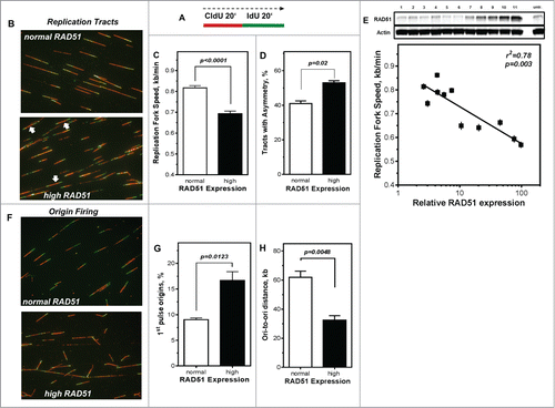 Figure 3. Perturbance of DNA replication processes in U2OS cells with high levels of RAD51. (A) Schematic of single DNA fiber analysis. Red tracts CldU; green tracts IdU. (B) Examples of various types of tracts like symmetric and asymmetric replication tracts in cells with normal (top) or high (bottom) RAD51 expression. (C) Replication fork speed in untreated U2OS cells with normal and high RAD51 expression. Cells were sequentially pulse-labeled with CldU followed by IdU and replication fork speed (kb/min) was detected by immunofluorescence with specific antibodies. Statistical analysis was performed using Student's t-test. (D) Percentage of asymmetrical replication tracts in cells with normal and high RAD51 expression. IdU/CldU length ratios from at least 1,400 replication tracts of at least 3 independent experiments were calculated by dividing IdU/CldU tracts and statistical analysis was performed using Student's t-test (right). (E) Influence of RAD51 protein expression in different U2OS strains on replication fork speed. Induction of high RAD51 expression was performed by addition of 1 µM Pon A for 24 hrs. After removal RAD51 expression was assessed over 120 days post Pon A treatment by Western analysis in total cell lysates from exponentially growing cells; β-actin was used as a loading control (top). Lane 11 represents RAD51 expression 24 hrs after induction. In parallel, replication fork speed was detected by immunofluorescence with specific antibodies at the same time points and plotted against relative RAD51 expression.. Data were fitted by linear regression analysis. (F) Examples and (G) relative frequency of 1st pulse origin firing in untreated U2OS cells with normal and high RAD51 expression. Cells were sequentially pulse-labeled with CldU followed by IdU, origins detected by immunofluorescence with specific antibodies and the percentage of 1st origins relative to all replication structures was calculated. Statistical analysis of at least 3 different experiments was performed using Student's t-test. (H) Quantification of ori-to-ori distances in U2OS cells with normal and high RAD51 expression. Length between adjacent origins was measured and expressed as ori-to-ori distances in kb. Data were collected from 3 different experiments and statistical analysis was performed using Student's t-test.