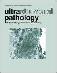 Cover image for Ultrastructural Pathology, Volume 41, Issue 2, 2017