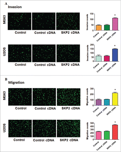 Figure 4. Overexpression of Skp2 promoted cell invasion and migration. (A) Left panel: The ability of cell invasion was measured via transwell assay in OS cells after Skp2 cDNA transfection. Right panel: Quantitative results are illustrated for left panel. (B) Left panel: The ability of cell migration was determined via transwell assay without Matrigel in OS cells after Skp2 cDNA transfection. Right panel: Quantitative results are illustrated for left panel.