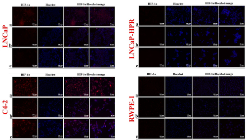 Figure 6. Immunofluorescence analysis shows the effect of the increasing Cab concentrations on the HIF-1α expression and subcellular localization in the Cab-treated cell lines. On the horizontal axis of the microphotograph group for each cell line, (a) control, (b) 5 nM, and (c) 10 nM cab. For each group, six independent images were obtained. In the groups for each cell line, the last two columns are the merged images for the indicated protein and nuclear staining with Hoechst dye. The scale bar represents 100 µm at 20X magnification. However, the microphotographs in the last column were obtained as larger images using a 50 µm scale bar at 20X magnification.