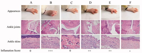 Figure 13. Effects of different administrations on paw appearances, histopathological images of ankle joints and skins. The degree of severity of inflammation is presented as 0 = normal; + =mild; ++=moderate; +++ =severe. The images presented are dedicated for (A) Normal (normal rats), (B) Model (RA rats without treatment), (C) Safety control (normal rats with Cel-Indo-NLCs-gel), (D) Cel-NLCs-gel (RA rats with Cel-NLCs-gel), (E) Indo-NLCs-gel (RA rats with Indo-NLCs-gel) and (F) Cel-Indo-NLCs-gel (RA rats with Cel-Indo-NLCs-gel) group.