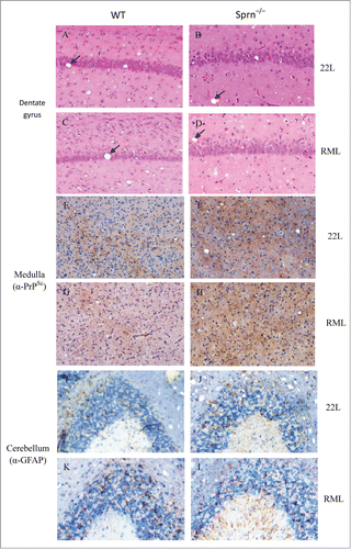 Figure 3. Histopathology of scrapie-infected WT and Sprn–/– mice. (A–D) Hematoxylin and eosin staining of dentate gyrus in WT and Sprn–/– mice infected with scrapie and examined at terminal illness. Changes associated with prion disease, including spongiform degeneration (black arrows in panels A–D). (E–H) Immunohistochemical analysis of spongiform degeneration in the medulla in 22L- or RML-infected WT and Sprn–/– mice, as detected using an antibody against PrP. PrPSc deposition was observed in all samples, but was higher in mutants than in WT for RML. (I–L) Immunohistochemical detection of astrogliosis in the cerebellum of 22L- or RML-infected WT and Sprn–/–mice, using an antibody against GFAP. Astrogliosis was confined to the granular layer in WT mice, but was observed in both the molecular and granular layers in mutants.