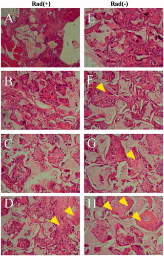 Figure 11. Histological evaluation with haematoxylin and eosin staining. Histological sections of rabbit radius defects with (A–D) and without (E–H) X-ray irradiation 12 weeks after the application of control (A and E), BM (B and F), BMP (C and G) and BM/BMP (D and H). The yellow triangle indicates the new bone formation. Scale bars are 100 μm.