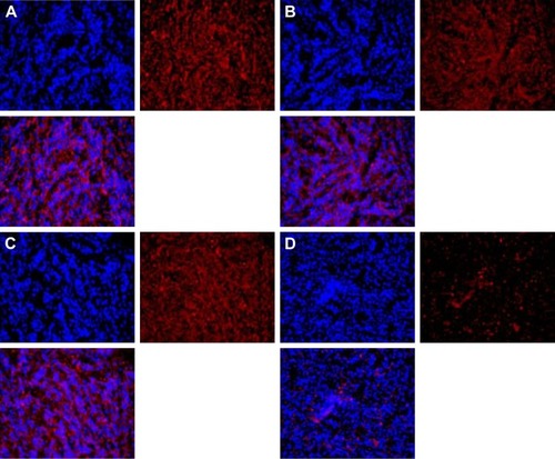 Figure 7 Gli1 expression in vivo.Notes: The Gli1 expression was determined by immunofluorescence with Gli1 antibody. The Gli1 expression of NS (A), DMP (B), and DMP–Consi (C) were higher than DMP–Gli1si (D). The result indicated that the Gli1 was successfully knocked down by the DMP–Gli1si complex.Abbreviations: DMP, 1,2-dioleoyl-3-trimethylammonium-propane and methoxy poly(ethylene glycol)-poly(lactide) copolymer; NS, normal salt.