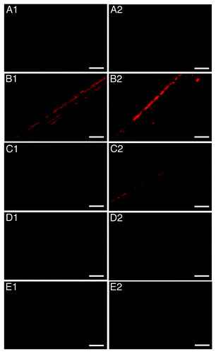Figure 4. Fluorescence Microscopy of stainless steel wires. (A) uncontaminated, (B–E) incubated with 10% hamster brain homogenate infected with the 263K prion strain and treated with 224 μg mL−1 Fe3+, 500 μg mL−1 h−1 H2O2, pH = 3.5 and UV-A for 0, 240, 360, and 480 min respectively. Each row of panels (1–2) demonstrates areas of wires of the same group. Bar: 200 μm