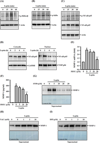 Figure 4 Effect of NF-κB on leptin-induced MMP-1 expression. (A–C) SV40 cells were exposed to 100 ng/mL of leptin for 15–60 minutes. Following this, phosphorylation levels of IKKα/β (A), IκBα (B), and NF-κB p65 (C) in cell lysates were examined via Western blotting. (D) For an extended treatment period, SV40 cells were incubated with 100 ng/mL of leptin for 2–6 hours, and the MMP-1 protein expression in both cytosolic and nuclear fractions was evaluated through Western blotting. (E) Investigating the impact of PDTC, SV40 cells were pre-treated with PDTC for 0.5 hours, followed by incubation with 100 ng/mL of leptin for 2 hours. The subsequent analysis focused on MMP-1 mRNA expression, assessed using RT-real-time PCR. (F) In a related experiment, SV40 cells were pre-treated with PDTC for 0.5 hours, followed by exposure to 100 ng/mL of leptin for 24 hours. The analysis centered on MMP-1 protein expression in supernatants and was assessed by ELISA. (G) Another pre-treatment experiment involved SV40 cells being incubated with SN50 for 0.5 hours, followed by incubation with 100 ng/mL of leptin for 24 hours. MMP-1 protein expression in supernatants was examined through Western blotting. (H) A separate pre-treatment study had SV40 cells being incubated with NAC for 0.5 hours, followed by exposure to 100 ng/mL of leptin for 24 hours. The analysis focused on MMP-1 protein expression in supernatants and was assessed by Western blotting. (I) In a different pre-treatment setup, SV40 cells were exposed to DPI for 0.5 hours, followed by incubation with 100 ng/mL of leptin for 24 hours. The subsequent analysis involved the assessment of MMP-1 protein expression in supernatants and was conducted through Western blotting. Data from ELISA and RT-real-time PCR are presented as the means ± SD from three separate experiments. The Western blotting images represent individual experiments. Findings denoting significance are marked as *p < 0.05 and ***p < 0.001 in comparison to leptin-activated cells.
