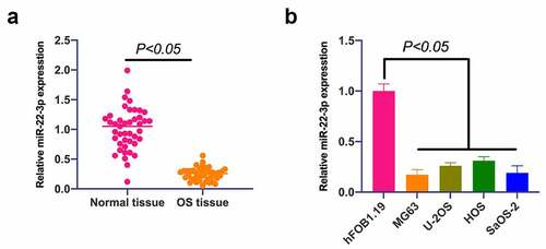 Figure 1. MiR-22-3p is declined in OS, and up-regulation of miR-22-3p represses OS growth. A. RT-qPCR to detect miR-22-3p expression in OS tissues and adjacent normal tissues; B. RT-qPCR to detect miR-22-3p expression in human normal osteoblast cell line hFOB1.19 and OS cell line MG63, U-2OS, HOS and SAOS-2. The values were shown as mean ± SD (Figure 1b, n = 3). The significance of each group was calculated using one-way ANOVA, and the variance correction via Tukey’s test.