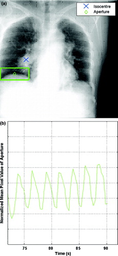 Figure 2.  kV projection used for CBCT reconstruction is shown in (a). The diaphragm and lesion are clearly visible on the projection with the aperture at the air-tissue interface. A trace used for sorting kV projections is shown in (b). The normalized mean pixel value of the aperture is calculated for each projection.