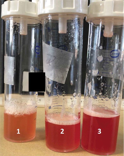 Figure 2. Bronchoalveolar lavage showing progressive hemorrhage in the absence of airway inflammation and purulence.