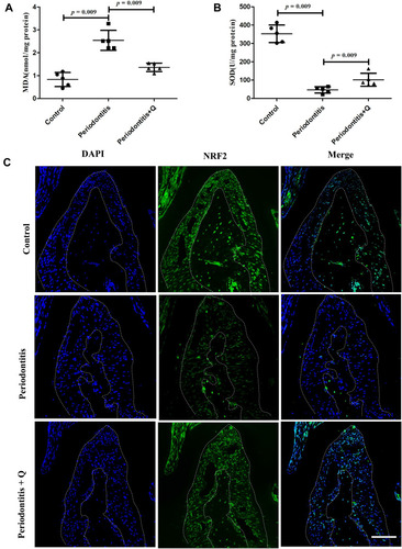 Figure 5 Quercetin alleviates OS and activates NRF2 signaling in vivo. (A) MDA levels in serum (n=5 each group). (B) SOD levels in serum (n=5 each group). (C) Representative immunofluorescence staining images of NRF2 in each group. Scale bar: 50 μm. All data are presented as the mean ± SD and specific p values are indicated on the graphs.