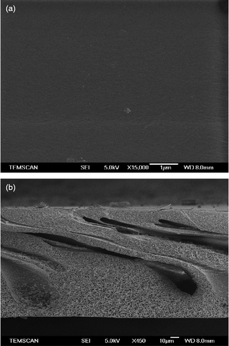 Figure 3 SEM image of the skin (a) and of the cross section (b) of the membrane obtained with 16% w/w CA, 6% LiCl and methyl lactate as a solvent.