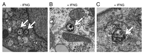 Figure 6. IFNG treatment induced rerouting of chlamydial early inclusions to autophagosomes. Transmission electron microscopy displays ultrastructural features of early C. trachomatis inclusions in infected THP1-derived macrophages. Host cells were exposed to medium containing 100 U/ml IFNG for 24 h or left untreated as a control. (A) Micrograph of infected untreated host cells shows normal chlamydial EBs (arrows) within the early inclusion. (B and C) Micrograph of infected cells exposed to IFNG demonstrates the presence of one EB (early inclusion) surrounded by a double membrane (B) or vesicles surrounding a morphologically abnormal chlamydial early inclusion (arrow) (C).