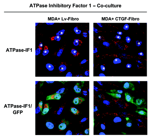 Figure 7. CTGF-fibroblasts greatly decrease the expression of ATPase-IF1 in adjacent MDA-MB-231 cells. To verify if CTGF-fibroblasts exert any paracrine effects on tumor cells, GFP-positive MDA-MB-231 cells were co-cultured with CTGF-fibroblasts or control fibroblasts for 3 d. Cells were then immuno-stained with antibodies against ATPase-IF1 (an endogenous inhibitor of the mitochondrial ATP synthase, RED). Nuclei were stained with DAPI (BLUE). Note that fibroblasts overexpressing CTGF reduce the levels of ATPase-IF in adjacent MDA-MB-231 cells (GFP). The white stars mark the nuclei of MDA-MB-231 cells.These results indicate that CTGF-fibroblasts increase the mitochondrial activity in adjacent breast cancer cells, by reducing ATPase-IF expression.