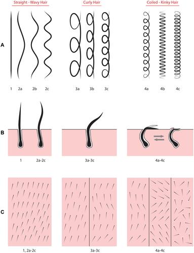 Figure 8 Drawing showing the different hair types by long hair shafts (row A), the subcutaneous shapes of follicular units (row B), and appearance from the surface after shaving to 2–3 mm (row C).