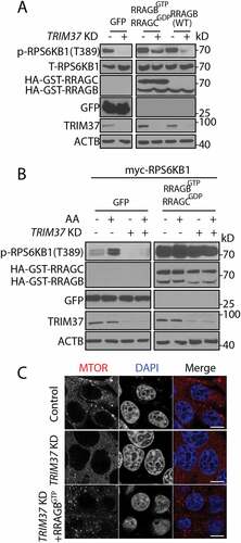 Figure 4. TRIM37 promotes MTOR signaling through RRAGB. (a) HepG2 control and TRIM37 KD cells were transfected with constructs encoding GFP only, RRAGBGTP (HA-GST-RRAGBQ99L) plus RRAGCGDP (HA-GST-RRAGCS75L), or HA-GST-RRAGB (WT). Cells were collected after 24 h of transfection, before proteins were detected by western blots. (b) HepG2 control and TRIM37 KD cells were transfected with constructs encoding myc-RPS6KB1, together with GFP or RRAGBGTP plus RRAGCGDP . After 24 h, cells were incubated with amino acid-depletion media for 2 h, followed by stimulation with amino acid-containing media for 15 min, before proteins were detected by western blots. (c) HepG2 control, TRIM37 KD cells and TRIM37 KD cells expressing FLAG-RRAGBGTP were immunostained with MTOR antibody. Nuclei were stained with DAPI. The images were acquired by confocal microscopy. Scale bars: 10 μm
