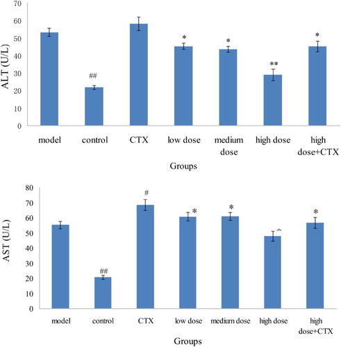 Figure 2. Effect of ABA on ALT and AST in serum in H22 liver tumor mice ( ± sd, n = 10). Note: acylated blueberry anthocyanin (ABA), alanine aminotransferase (ALT), aspartate aminotransferase (AST) compared with model group, #P < .05, ## P < .01; compared with CTX group, *P < .05, ** P < .01.