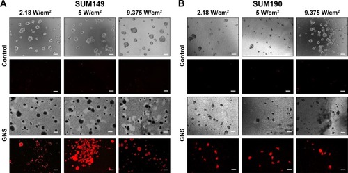 Figure 6 Photothermal treatment of SUM149 (A) and SUM190 (B) tumor emboli. After 96 hours of tumor emboli maturation, 0.15 nM of GNS was incubated with tumor emboli for 24 hours. Following GNS incubation, samples were exposed to an 808 nm continuous laser at various laser intensities. After treatment, the experimental samples were stained with propidium iodide to illustrate any cellular death that occurred following laser irradiation. All emboli that were incubated with GNS exhibited cell death following laser exposure. Control samples were treated with the same level of irradiation, which demonstrated virtually no cell death. Representative phase-contrast images of each sample following treatment are shown. Empty spaces seen under phase-contrast for GNS-labeled emboli are due to the repositioning of the emboli in the wells following photothermal treatment. The GNS-labeled emboli appear in black color under phase-contrast imaging due to GNS uptake, compared to the unlabeled controls (scale bars =100 μm).Abbreviation: GNS, gold nanostars.