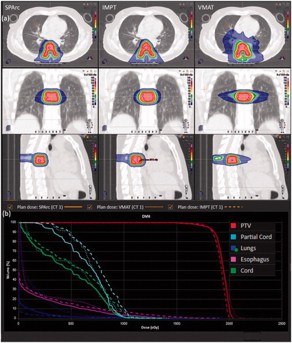 Figure 1. (a) Isodose distributions for treatment plan using SPArc (the first column), IMPT (the second column), and VMAT (the third column) of patient #1. (b) The corresponding DVHs comparison for a spine SBRS patient #1.