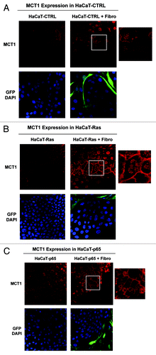 Figure 9. Co-culture with fibroblasts upregulates the expression of MCT1 in Ras-transformed and NFkB-expressing epithelial cells. HaCaT epithelial cells (control, H-Ras [G12V], or NFkB [p65]) were co-cultured for 5 days with hTERT-immortalized fibroblasts (GFP+). Alternatively, HaCaT cells were cultured alone (without fibroblasts) for the same amount of time. Then, the cells were fixed and immunostained with specific antibody probes. Note that MCT1 expression and plasma membrane localization is increased most significantly in HaCaT-Ras cells and HaCaT-p65 cells co-cultured with fibroblasts, relative to the same HaCaT cells cultured alone. Insets at higher magnification are shown to highlight the plasma membrane staining of MCT1. DAPI (blue nuclear staining) is also shown for reference.