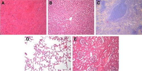 Figure 7 Histological assessment.Notes: Representative H&E staining photomicrographs of the (A) heart, (B) liver, (C) spleen, (D) lung, and (E) kidney in HCPT-AuNPs-50 group (×100). HCPT-AuNPs-50: HCPT-AuNPs of an average diameter of 50 nm.Abbreviations: H&E, hematoxylin and eosin, HCPT, 10-hydroxycamptothecin; AuNPs, gold nanoparticles.
