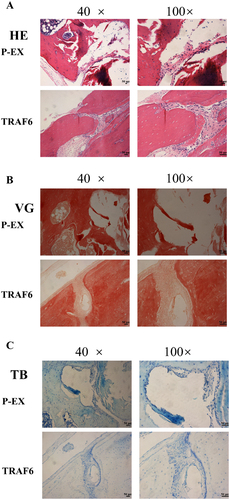 Figure 6. The osteogenic effect of TRAF6 was analysed by histomorphology staining. a: The osteogenic effect of TRAF6 was analysed by HE stanning. b: The osteogenic effect of TRAF6 was analysed by VG staining. c: The osteogenic effect of TRAF6 was analysed by TB staining. P-EX: blank vector; TRAF6: vector of overexpression of TRAF6. HE: Hematoxylin and eosin; VG: Van Gieson; TB: Toluidine blue.