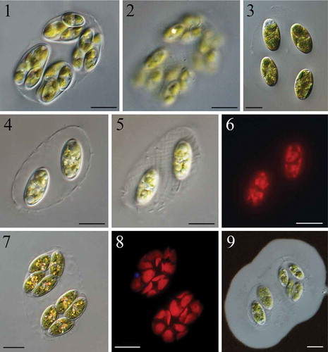 Figs 1–9. Light microscopy of Reticulocystis yunnanensis: Fig. 1. Characteristic composite colony morphology in field-collected sample. Fig. 2. Details of mother cell wall of composite colony show the obvious fibrillar network structure in field-collected sample. Fig. 3. Characteristic simple colony when cultured. Fig. 4. Characteristic simple colony in natural sample. Fig. 5. Details of mother cell wall of simple colony showing the fibrillar network structure in field-collected sample. Fig. 6. Autofluorescence shows the shape of chloroplasts in old cells. Fig. 7. Mature cells with numerous assimilate particles. Fig. 8. Autofluorescence shows the shape of chloroplasts in mature cells. Fig. 9. Negative staining with Indian ink showing mucilaginous envelopes. Scale bar: Figs 1–9, 10 μm