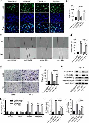 Figure 1. DEX inhibits VSMC phenotype switch. (a-b) BrdU incorporation assay for assessing VSMC proliferation in each group. (c-f) Wound healing and Transwell assays for evaluating VSMC migratory ability in each group. (g-h) Western blotting for examining protein levels of contractile markers (α-SMA and SM-22α) and synthetic markers (vimentin, osteopontin). (i-j) ELISA for measuring production of cytokines (TNF-α, IL-6) in VSMCs. Each experiment was performed in triplicate.Each experiment was performed in triplicate. **p˂0.01 vs. control+ DMSO group; #p˂0.05 vs. Ang II+ DMSO group; &p˂0.05 vs. control+ DEX group.