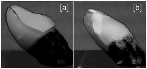 Figure 4. The typical fracture appearance of restorations made from brittle materials (Emp, XTE and eMx groups) (a) and restorations made from single-structure FRCs (a-FRC and s-FRC groups) (b). For the restorations made from the brittle materials, catastrophic failures were observed in which an initial crack initiated the fracture with a single fracture line (a). For restorations made from single-structure FRCs, local crushing failures were observed (b). The restorations made from FRCs maintained their original shapes until fracture, although multiple fracture cracks occurred in the incisor edge of the restorations. Abbreviation: FRC: fiber-reinforced composite.