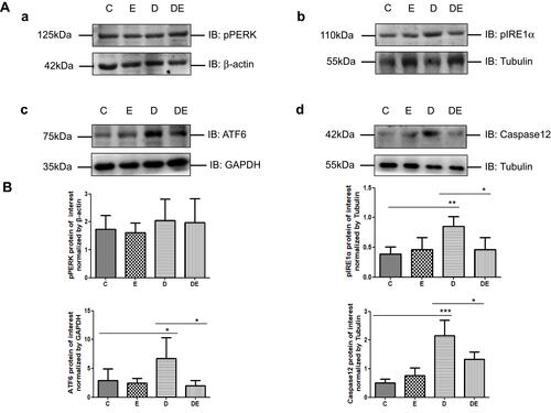 Figure 5 Type 2 diabetes exacerbates ER stress leading to ERAD, which is mitigated by swimming (A,B). (a–d) Western blots of p-PERK, p-IRE1α, ATF6 and caspase 12 in gastrocnemius muscles of mice in groups C, E, D, and DE (n = 6 per group. *P < 0.05, **P < 0.01, and ***P < 0.001.