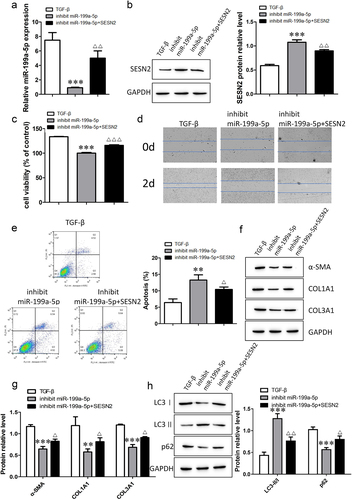 Figure 7. The miR-199a-5p/SESN2 axis regulates fibrogenesis via autophagy. a: The expression of miR-199a-5p was determined by RT–qPCR. b: The expression level of SESN2 protein was detected by Western blotting. c: Cell viability was analyzed by a CCK-8 assay. d: Cell migration ability was evaluated by a wound healing assay. e: Flow cytometric detection of cell apoptosis. f- h: Western blotting verification of α-SMA, COL1A1, COL3A1, LC3I, LC3II, and p62 protein expression levels. ***p < 0.001 and **p < 0.01 compared with the TGF-β group; ***p < 0.001, **p < 0.01, and *p < 0.05 compared with the miR-199a-5p-inhibition group. TGF-β: TGF-β-induced group, inhibit miR-199a-5p: TGF-β-induced with miR-199a-5p-inhibition group, inhibit miR-199a-5p+SESN2: TGF-β-induced with miR-199a-5p- and SESN2-inhibition group. Data are presented as means ± SD (n = 3).