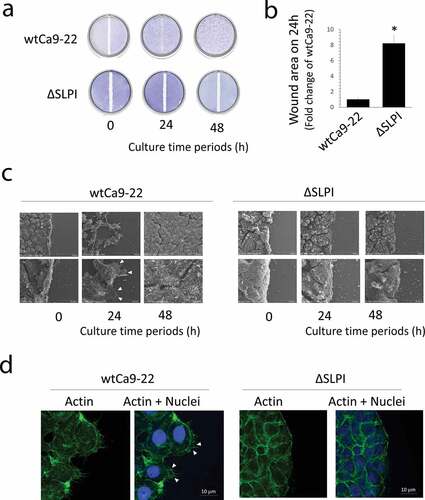 Figure 1. (a) A scratch ‘wound’ was made using a silicone tip at the center of a confluent monolayer culture and the cells were further cultured for the indicated duration. The cell layers were fixed and stained with toluidine blue. (b) Cell migration was quantified in the wound areas 24 h after injury. Quantitative data were presented as the mean ± standard deviation (n = 3, *P < 0.05 vs. wtCa9-22). (c) Cells were cultured under the same conditions as in (a) and were observed using SEM. The arrow heads indicate the lamellipodia. (c) Histochemical staining of wtCa9-22 and ΔSLPI cells highlighting the original scratch zone. Cells were cultured under the same conditions as in (A). (d) Histochemical staining was performed using Alexa FluorTM 488 phalloidin (green). Nuclei were stained with DAPI (blue). Arrow heads indicate the lamellipodia.