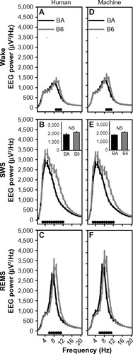 Figure 11 Strain differences in EEG power spectra in 10-second epochs scored by human or machine.