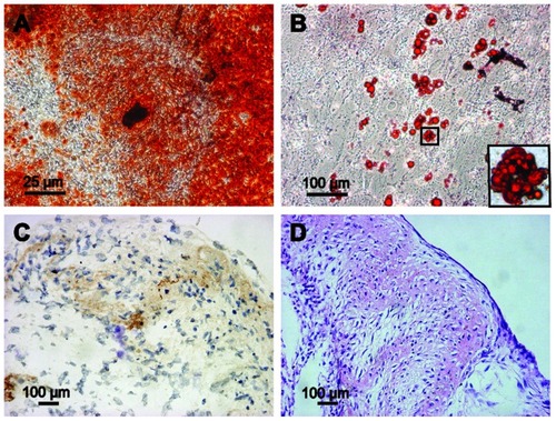 Figure 3 Multipotent differentiation of GFP-ADSCs. (A) Alizarin Red detected calcium mineralization in osteogenic cultures of GFP-ADSCs for 3 weeks in vitro. (B) Oil Red O staining detected red-colored oil granules in adipogenic cultures of GFP-ADSCs (magnified view of the square area in [B]). (C and D) For chondrogenic differentiation, histological and hematoxylin and eosin staining results showed that cartilage lacunae were formed and expressed chondrocyte gene markers, collagen II (C and D).Notes: Scale bar A measures 25 μm, B, C, and D measure 100 μm.Abbreviation: GFP-ADSCs, green fluorescent protein adipose-derived stem cells; HE, hematoxylin and eosin.