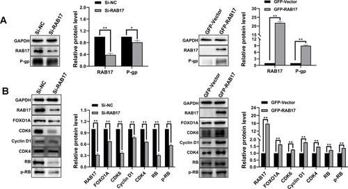 Figure 3 RAB17 regulates a variety of cellular behaviors in A2780/PTX and A2780 cells by activating the CDK6/RB signaling pathway. (A) Expression of P-gp protein was observed after knockdown and overexpression of RAB17 in A2780/PTX and A2780 cells respectively, *p<0.05, **p<0.01. (B) Expression of cell cycle related proteins was observed after knockdown and overexpression RAB17 in A2780/PTX and A2780 cells respectively, **p<0.01.