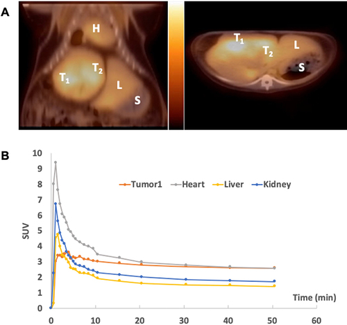 Figure 3 PET imaging of ZD2-[68Ga-NOTA] with woodchuck (#1701). (A) PET/CT overlays of coronal (left) and axial (right) cuts showing uptake in one HCC (T1 for tumor 1) with L for liver, S for stomach, and H for heart; (B) region-based uptake (in SUVs) as time activity curves for these organs.