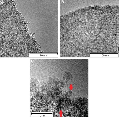 Figure 2 Overview TEM image of SEONDEX 2.0 particles shows agglomerates of SPIONs in a polymer matrix (A). Overview TEM image of SEONDEX 4.5 particles shows individual SPIONs embedded in a polymer matrix (B). Higher magnification of SEONDEX 2.0 particles, with visible lattice planes (C).Abbreviations: TEM, transmission electron microscopy; SPIONs, superparamagnetic iron oxide nanoparticles; SEONDEX, dextran-coated SPIONs.
