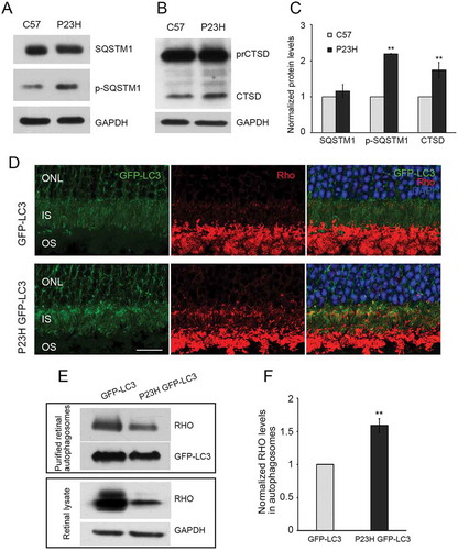 Figure 2. Autophagy in photoreceptors of P23H mice results in increased degradation of RHO through the autophagosome-lysosome pathway. Representative western blots probed for SQSTM1, p-SQSTM1 (a), precursor CTSD (prCTSD) and mature CTSD (b) in retinas of 1-month-old P23H and control C57BL/6J (C57) mice. (c) Quantification of intensities of immunoblot bands from A and B normalized to loading control GAPDH (n = 6), with C57 values set to 1. (d) Retinal cryosections from 1-month-old GFP-LC3 and P23H GFP-LC3 mice probed for RHO (red), with DAPI staining of nuclei (blue). IS, inner segment; ONL, outer nuclear layer; OS, outer segment. Scale bar: 20 µm. (e) Immunoblot and (f) quantification of RHO levels in autophagosomes isolated from retinas of GFP-LC3 and P23H GFP-LC3 mice (E, upper panel) versus from total retinal lysate (E, lower panel). Normalization of RHO levels in the autophagosome is relative to total amount of RHO in retinal lysate, as this represents the proportion of RHO being taken up by the autophagosome (n = 4). Data are presented as mean ± SD. **, p < 0.01, unpaired t-test.