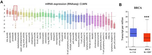 Figure 1 The mRNA expression of CLMN in BRCA. (A) CLMN expression overview in human cancer cell lines. Red box indicated BRCA. (B) Differential expression of CLMN in normal and breast cancer tissues. ***P<0.001.
