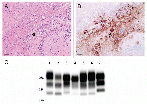 Figure 1 Neuropathology and PrPcore characteristics of L-BSE-affected TgHaNSE mice. (A) hematoxylin and eosin staining of the corpus callosum of mice. (B) PrPSc deposition was detected in the semiserial sections. PrP-plaque is indicated by an arrow. PrP was detected by mAb SAF-84. Scale bars: 200 mm. (C) PrPSc in L-BSE affected TgHaNSE mice was detected by western blotting. Lane 1: C-BSE (cattle), lane 2: L-BSE (cattle), lane 3: C-BSE affected hamster, lane 4: L-BSE affected hamster, lanes 5 and 6: L-BSE affected TgHaNSE, lane 7: scrapie Obihiro-affected mouse. PrP was detected by mAb T2.